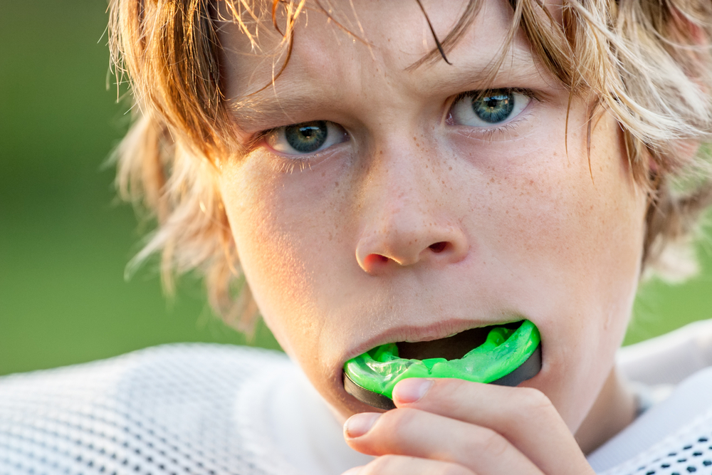 Ask Your Pleasanton Dentist: Sports Mouth Guards