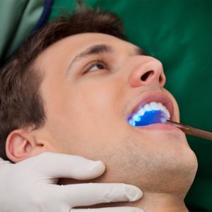 Republic Dental and Orthodontics Pleasanton services dental sealants
